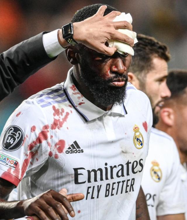 开云体育下载-阿扎尔果然又演砸了，国家德比前该为皇马担心吗？